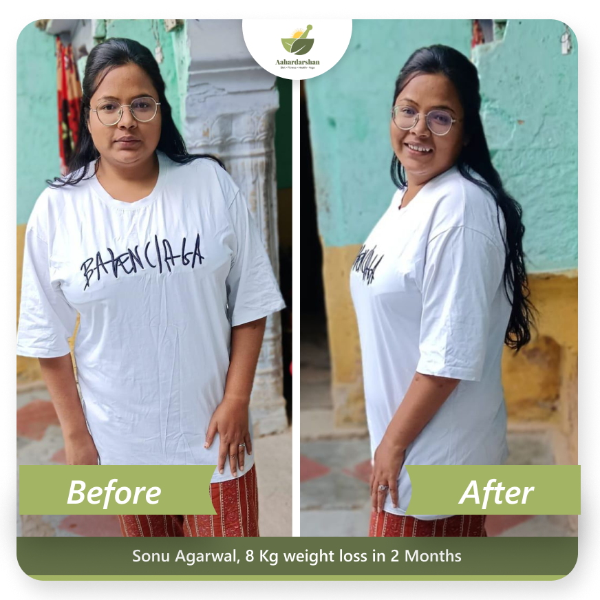 Sonu Agarwal Transformation